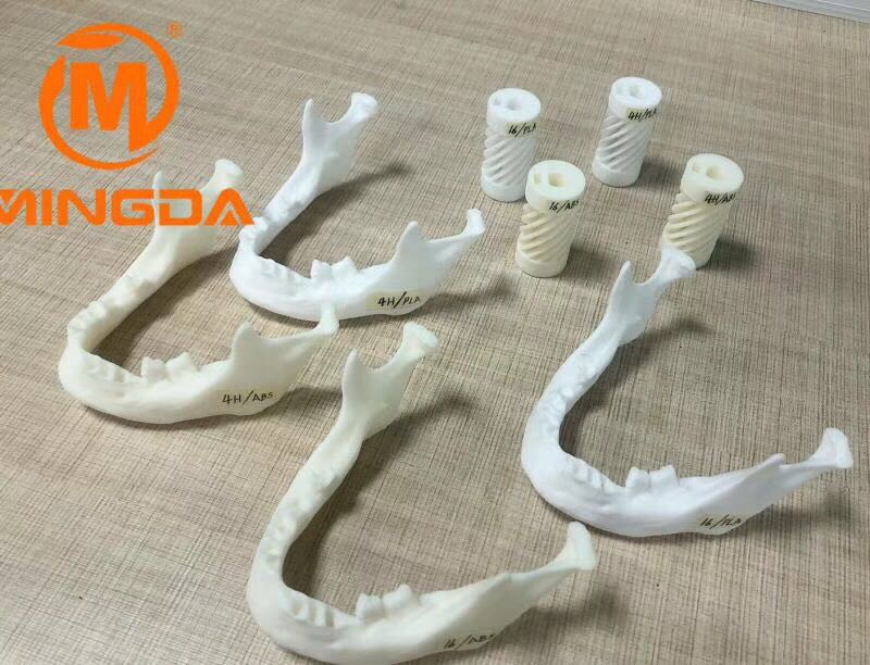 工業(yè)級3D打印機在牙科行業(yè)的應(yīng)用(圖1) 工業(yè)級3D打印機在牙科行業(yè)的應(yīng)用(圖1)