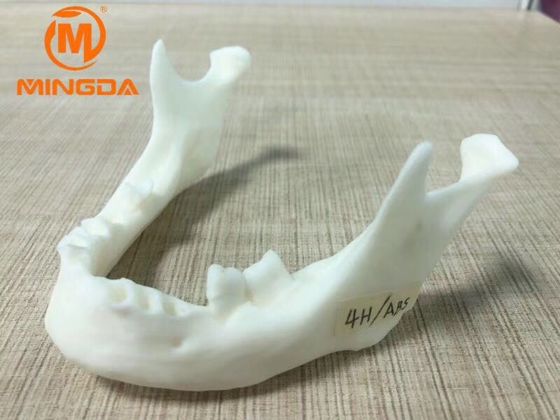 工業(yè)級3D打印機在牙科行業(yè)的應(yīng)用(圖1) 工業(yè)級3D打印機在牙科行業(yè)的應(yīng)用(圖1)